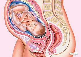 Шейка матки при беременности – осложнения при родах