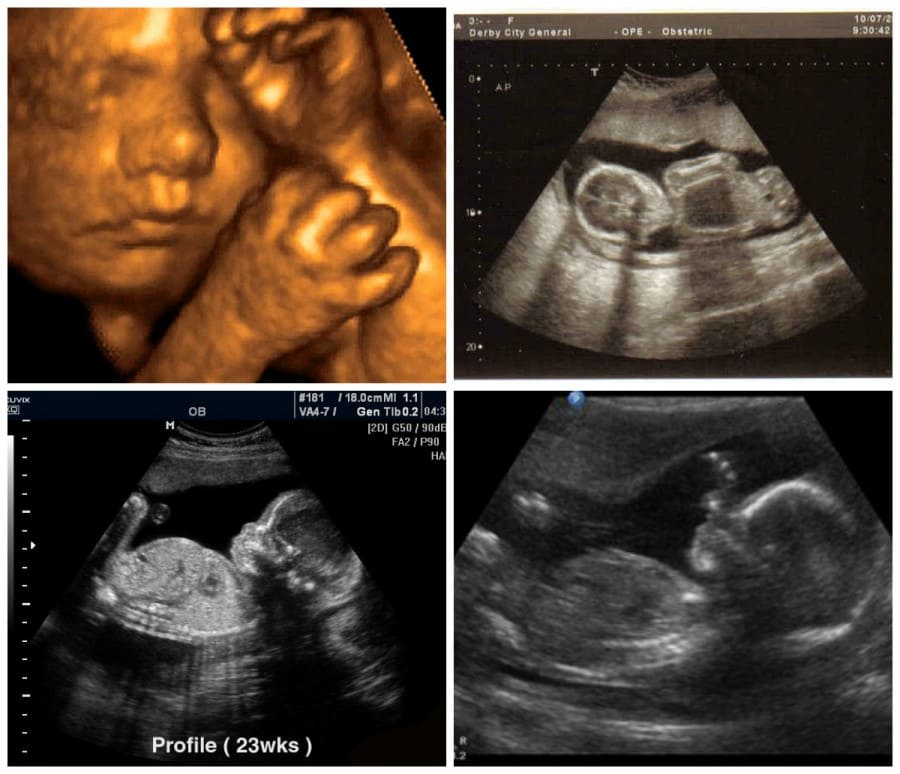 Как выглядит ребенок на 23 неделе беременности в животе фото