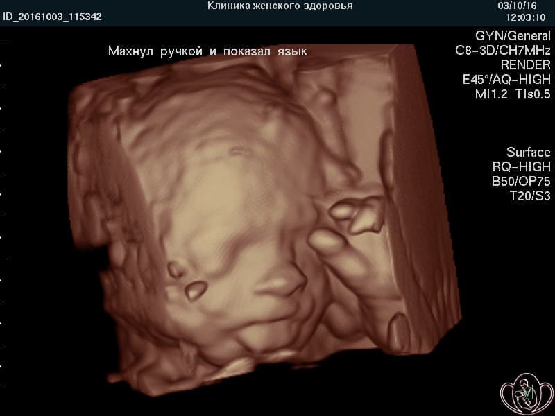 Снимок УЗИ на 28 неделе беременности